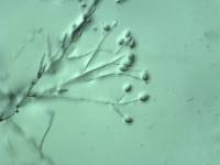 sporangiophore portant des sporanges de Phytophthora infestants